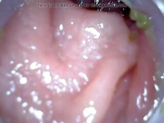 Anal endoscope parte 1, grátis enema punição hd xxx filme 04